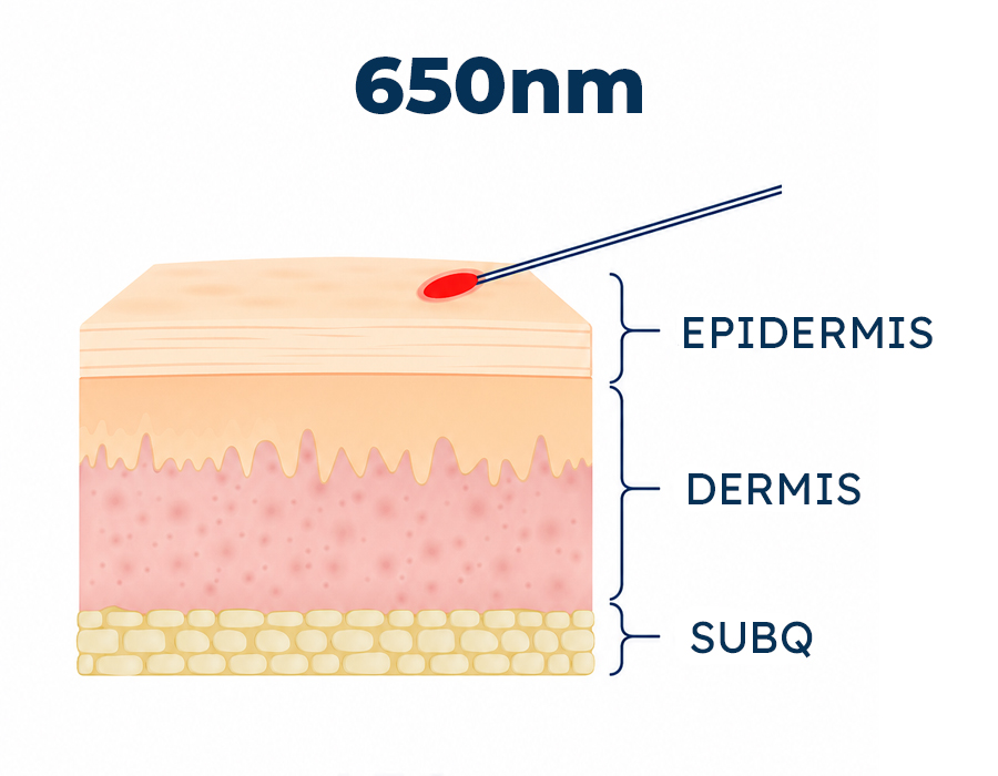 650nm